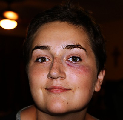 Punched in the Face!